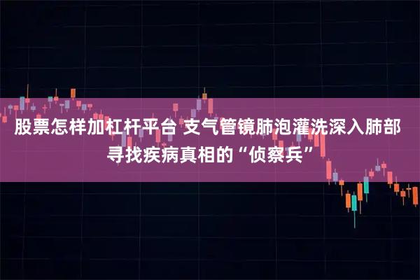 股票怎样加杠杆平台 支气管镜肺泡灌洗深入肺部 寻找疾病真相的“侦察兵”
